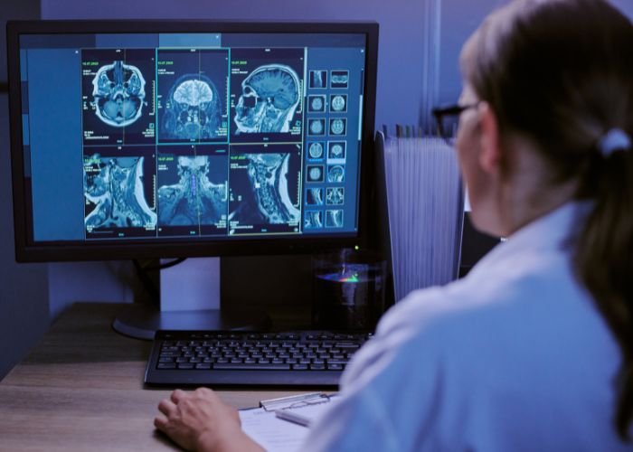 Advances In Neurology Treatment and Brain Care