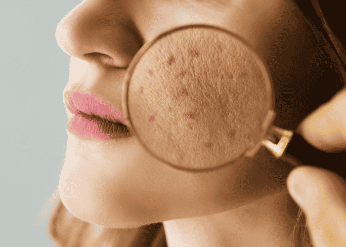 Common Skin Problems and How Dermatology Can Help