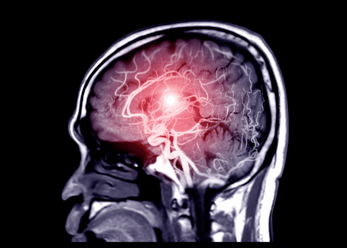 How Neurosurgery Helps Treat Complex Brain and Spine Conditions