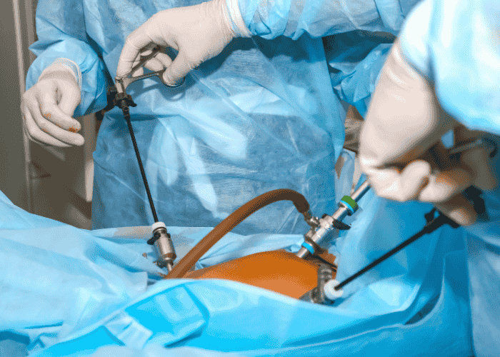Laparoscopic Surgery: Minimally Invasive Treatment for Faster Recovery