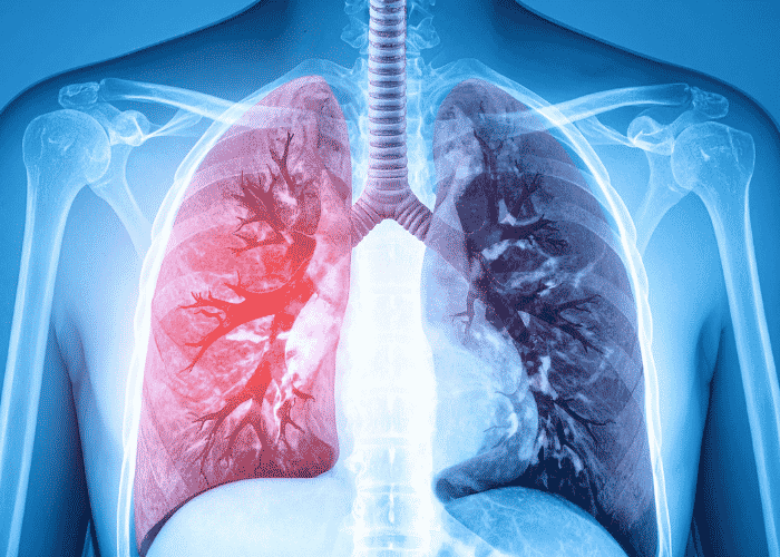 Modern Advances in Chest and Pulmonary Care