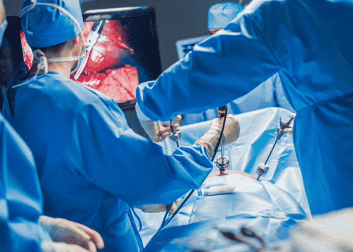Understanding Laparoscopic Surgery: Benefits, Procedures, and Recovery