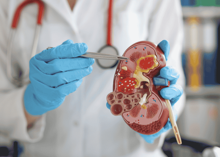 Urology Care for Men and Women: What You Need to Know