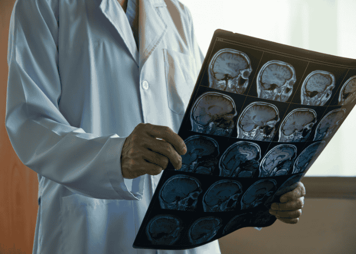When Do You Need a Neurosurgeon? Signs and Treatment Options